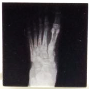 Custom Lego X 光片平面磚