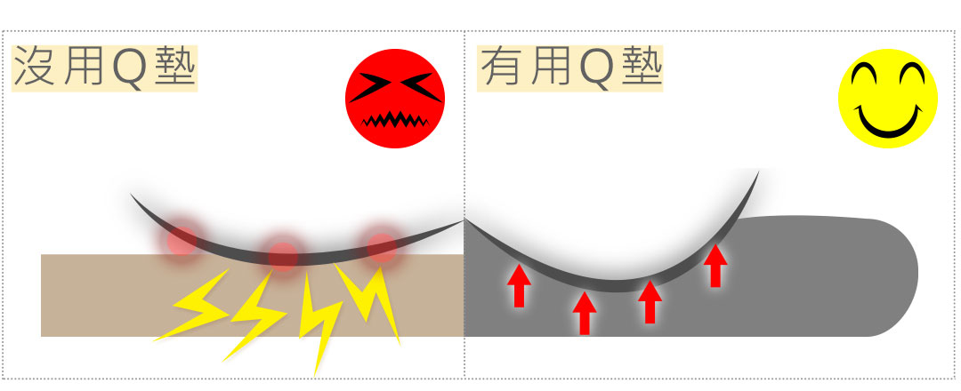 屁股久坐會痛？有Q坐墊/沒用坐墊