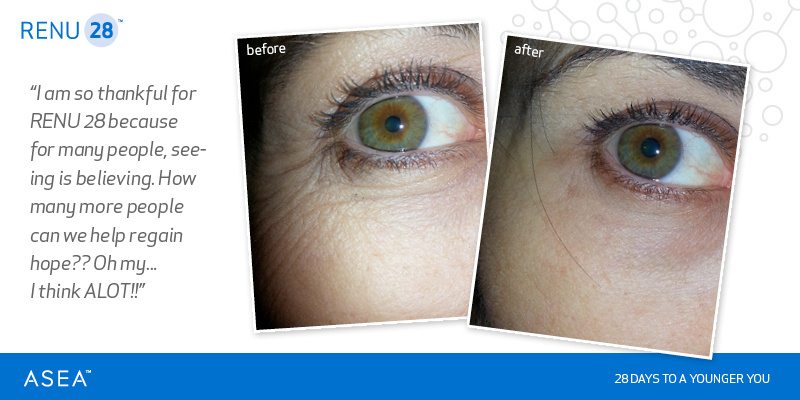 RENU28 活膚凝膠【正品】ASEA