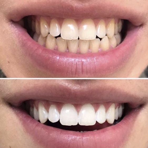 curaprox,biw,牙膏,牙刷,護齒,齒,瑞士,牙刷界愛馬仕