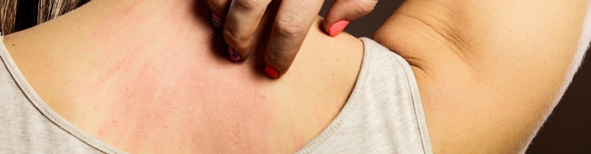 精油的最高安全稀釋濃度