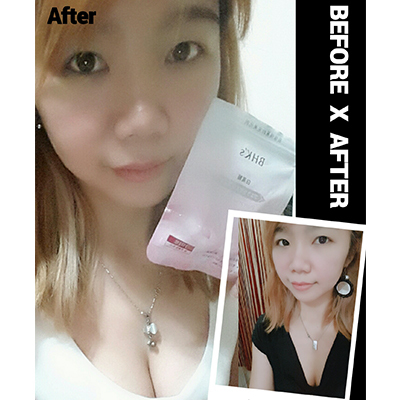 業務專員  小p：活到34歲了，沒想到竟然可以靠BHKs白高顆讓胸部變大！