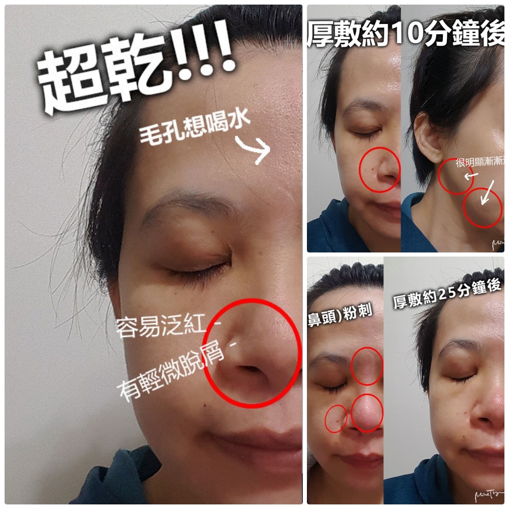 CEBELIA、過敏、曬傷、修復、寡胜肽瞬效修復霜