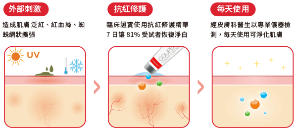 經法國里昂專業化妝品臨床實驗室 Dermscan 研究證實 (16E3558),早晚使用抗紅修護精華七日後,81%受試者感到肌膚明顯恢復淨白,彈性與光澤