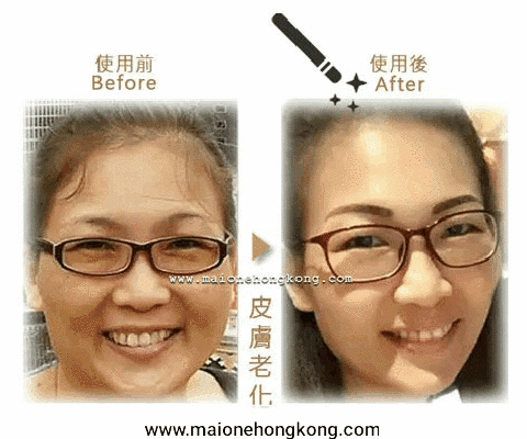 MAIONE【正品】100ml 青春定格原液*升級版*(神奇拉提噴霧)