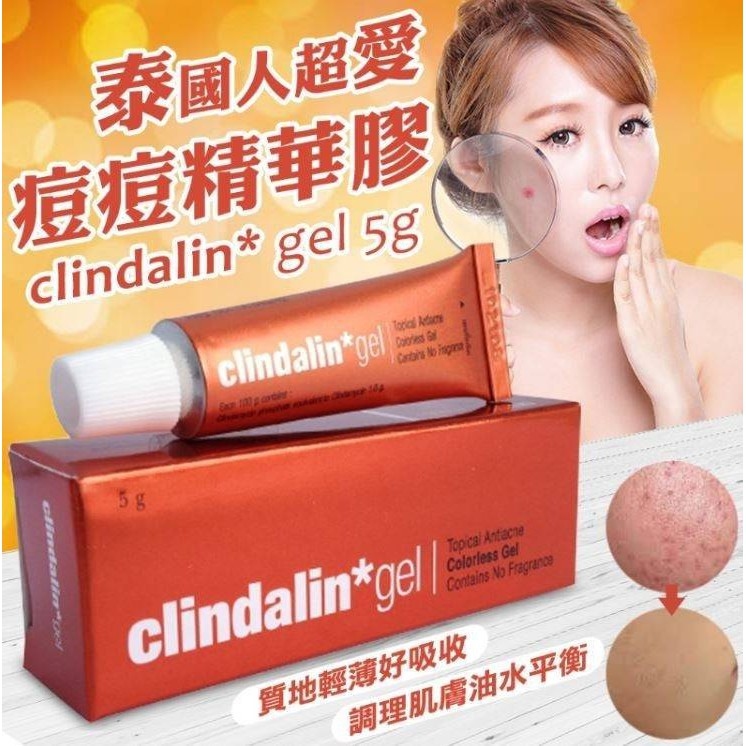 泰國直送 Clindalin  暗瘡膏 Clindalin gel 5g / 10g