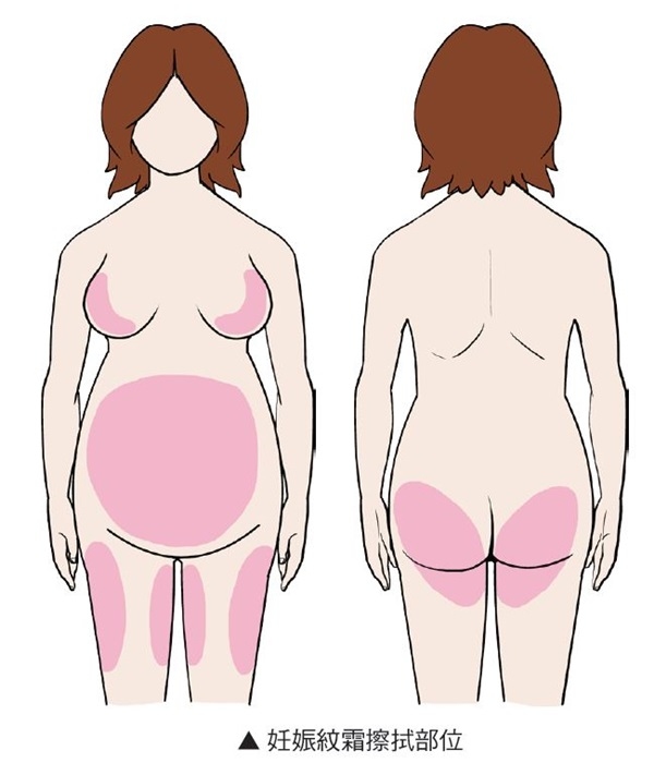 懷孕時妊娠紋霜擦拭部位,妊娠紋油