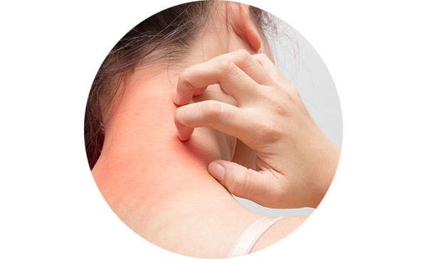 假發熱衣會讓身體悶癢