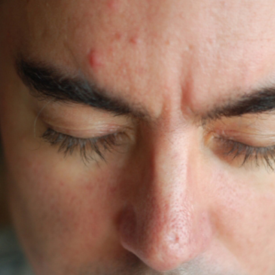 臉越洗越糟？可能沒選對適合膚質產品