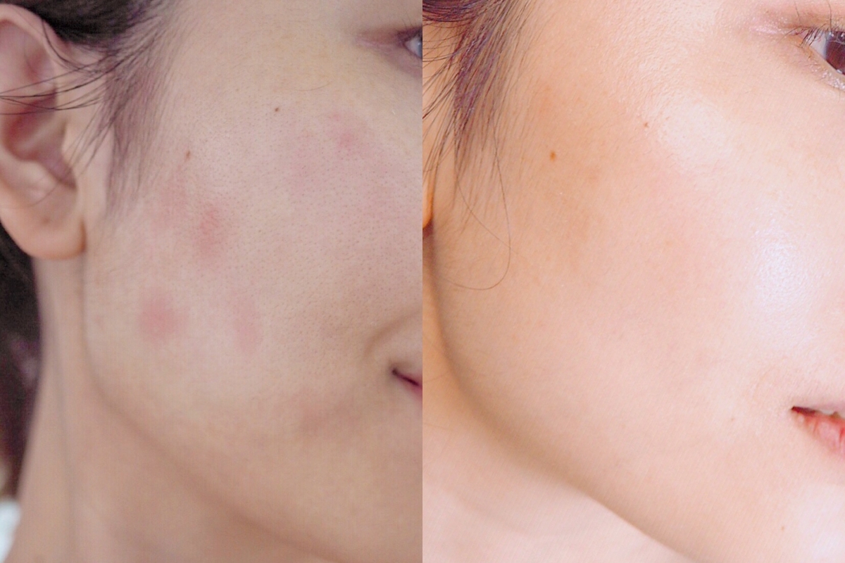 南僑的洗臉皂和沐浴皂都有通過美國AMA實驗室認證以及美國皮膚科醫師審核，敏感肌完全可以放心使用！