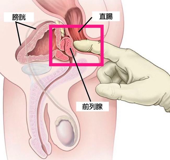 肛交,前列腺,男生肛交,同志,後庭玩具,後庭,肛塞