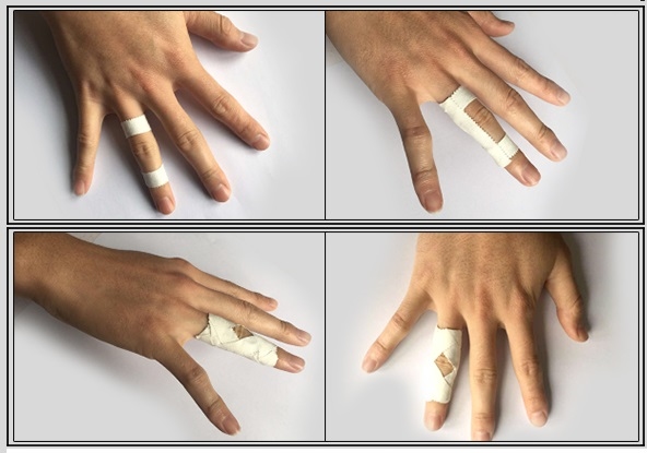 *買一卷送一卷* ALL-ROUNDED 0.5吋(1.25cm*10m)白貼 手指及小部位運動防護