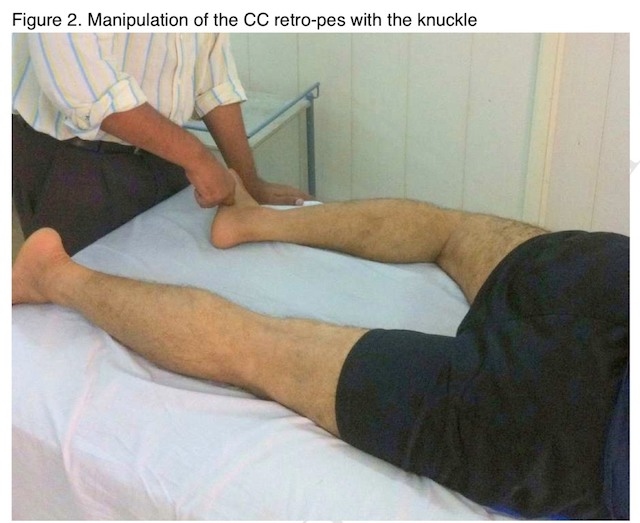 筋膜運動學 筋膜鬆弛術對於acl和半月板修復後膝蓋的持續疼痛