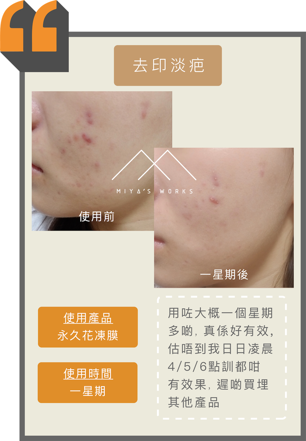 經常凌晨休息使用永久花凍膜有效去印淡疤