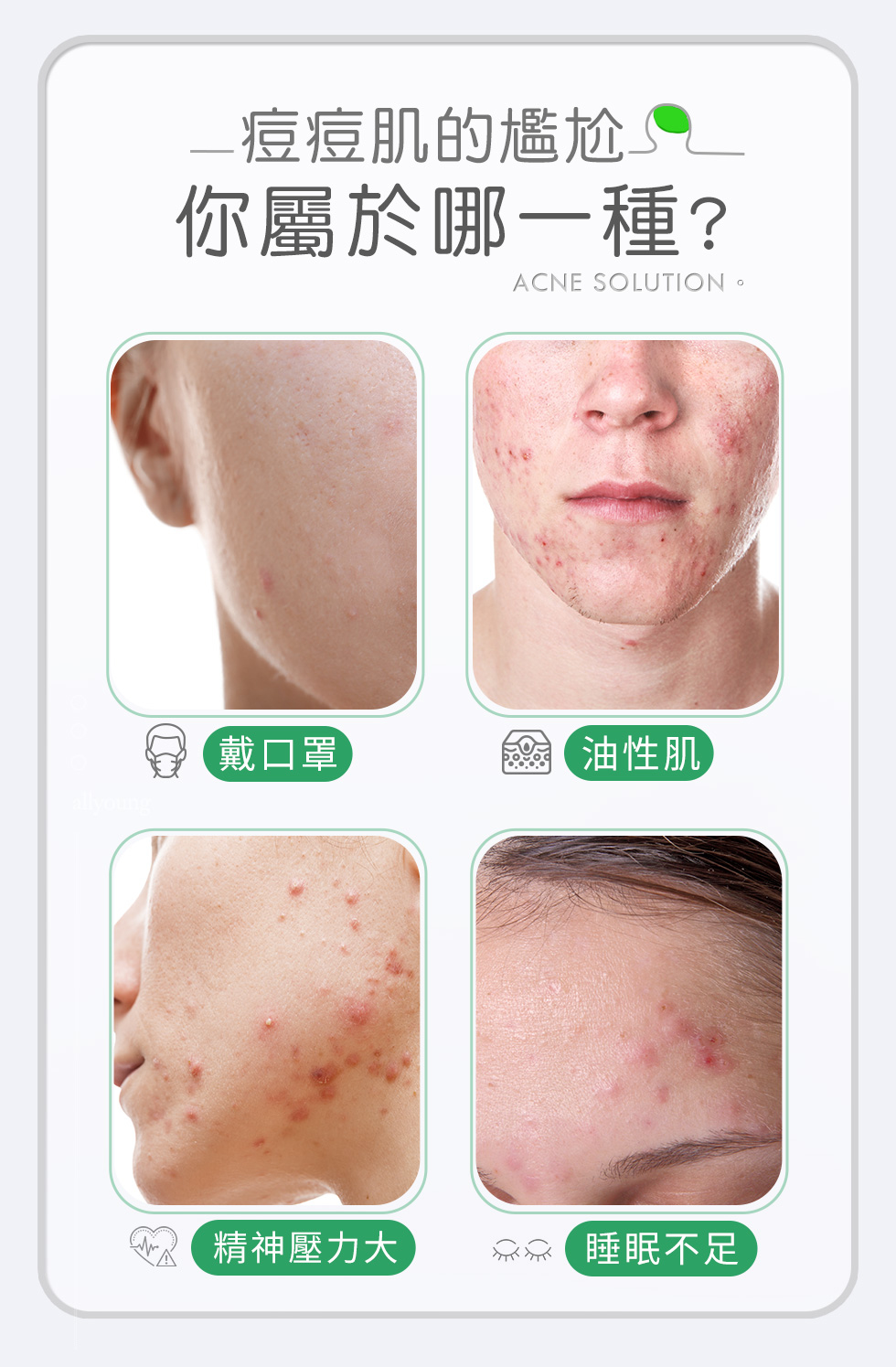 長痘肌的尷尬，你是哪一種？