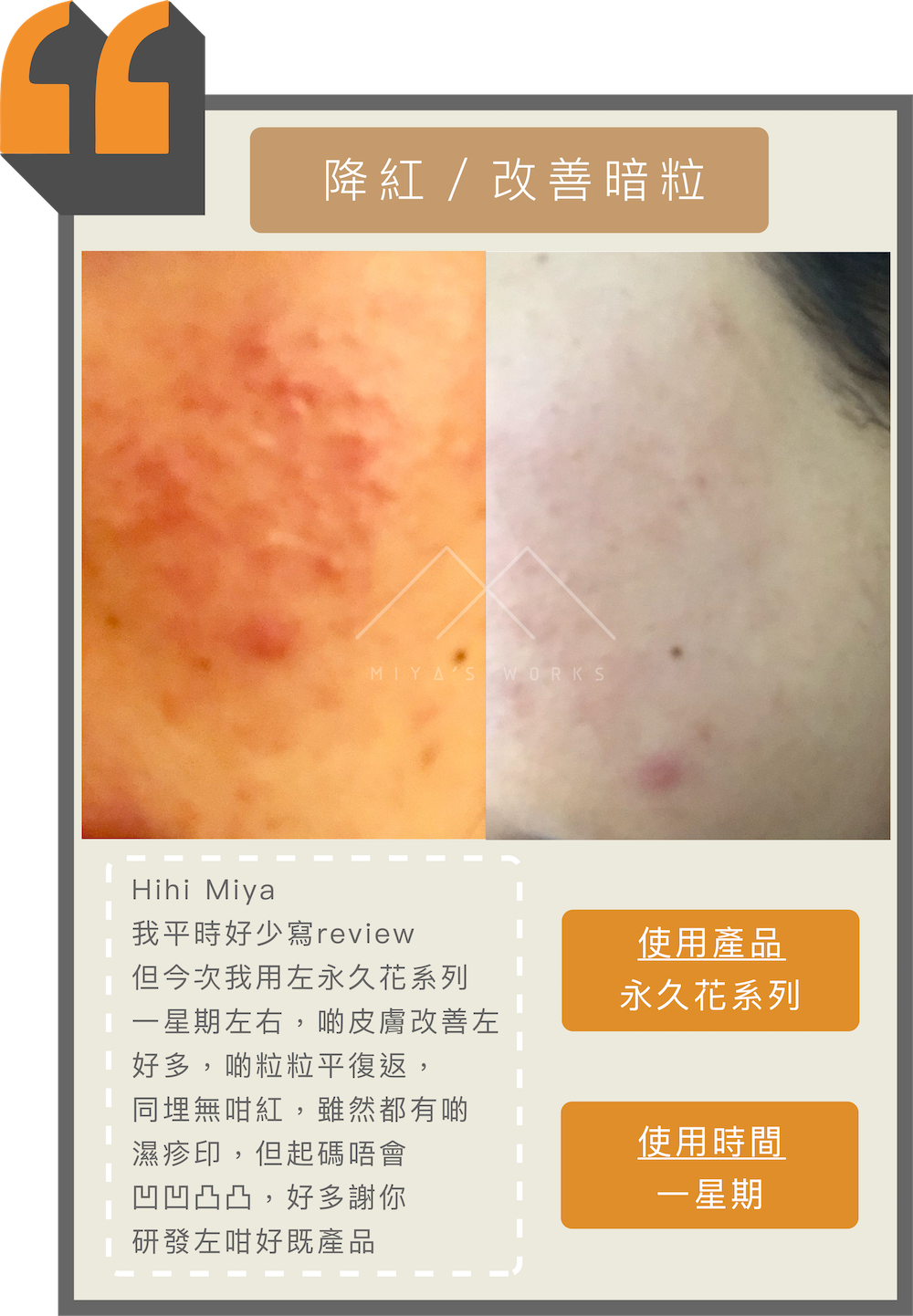 使用永久花系列產品改善暗粒及降紅