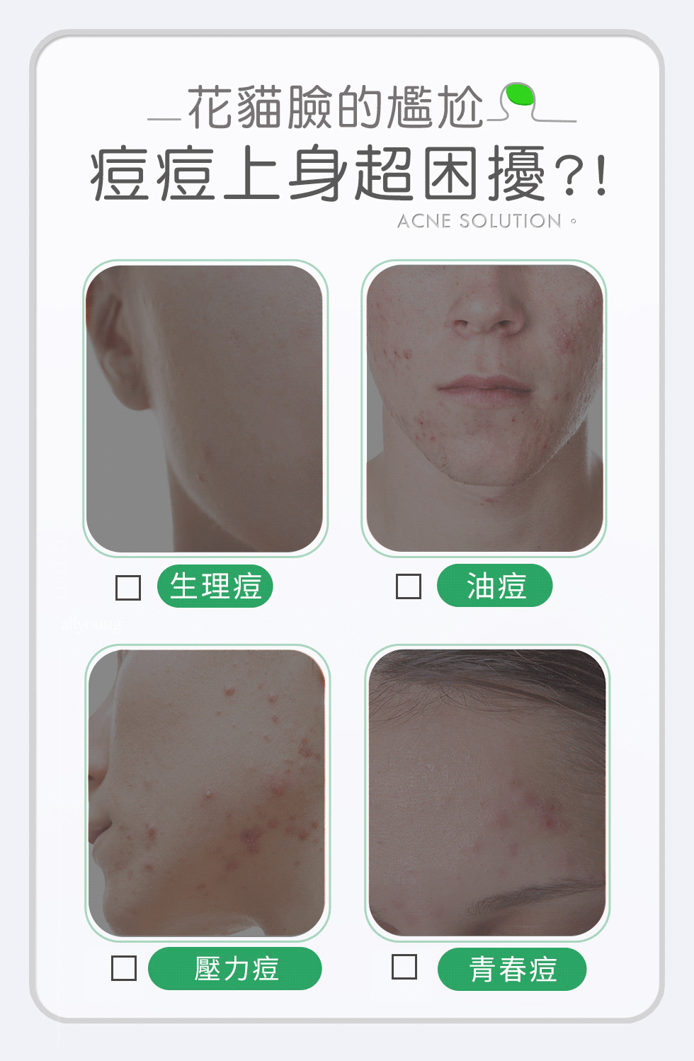 痘肌的尷尬，你是哪一種？