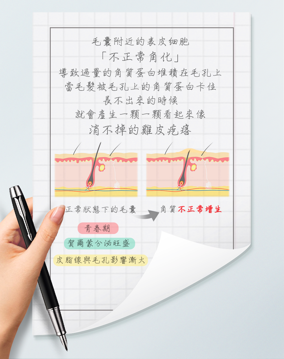 毛孔堵塞導致不正常角化