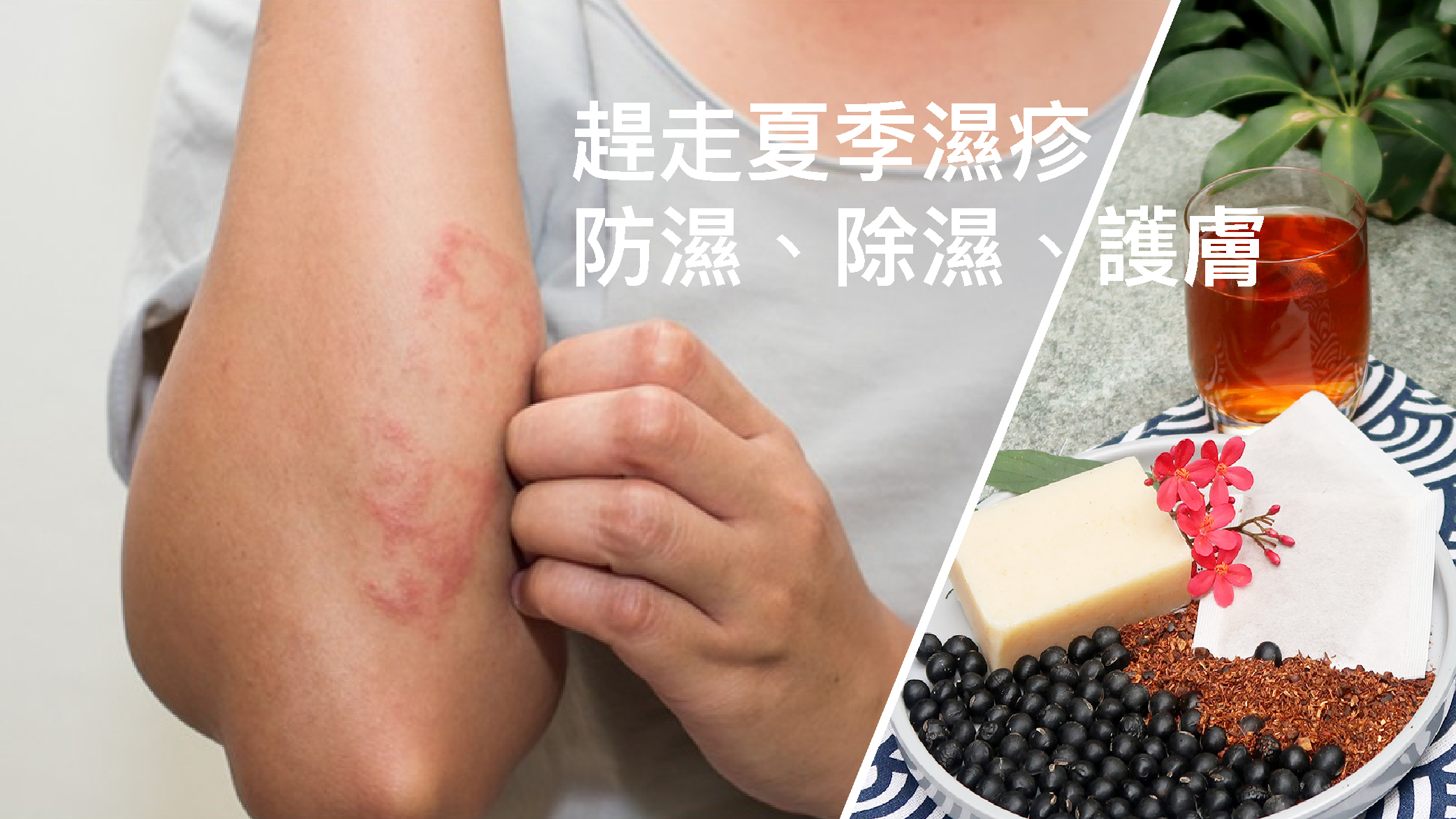 趕走夏季濕疹   香港夏天天氣炎熱，大熱天時熱刺刺，汗水濕透衣服，皮膚醃至紅腫瘙癢，修復好的濕疹都翻發了。 晚上因為瘙癢更失眠到天光。精神困擾之餘，還影響正常工作和生活。