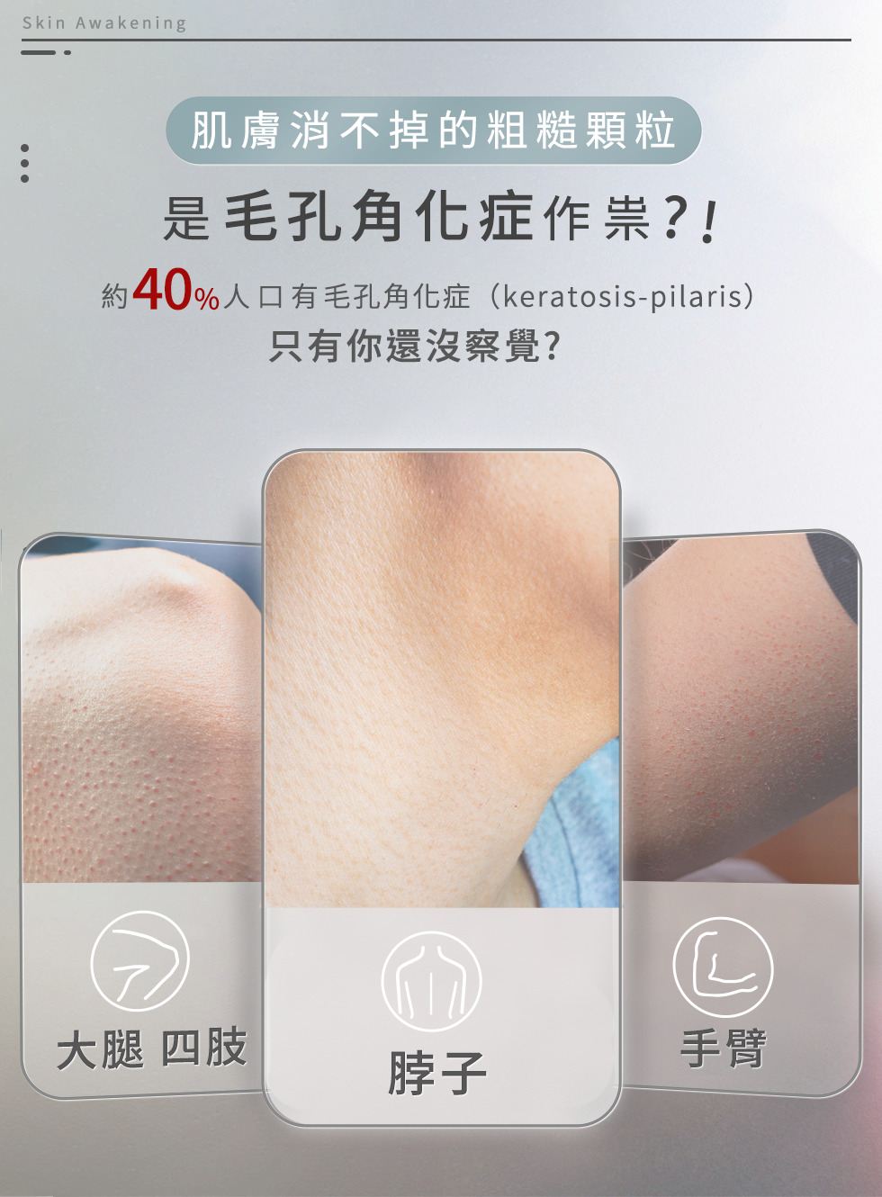 還沒察覺毛孔角化症作祟？