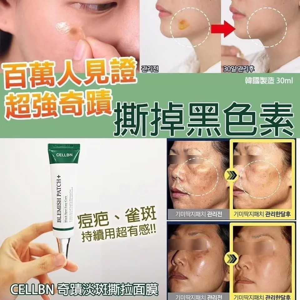 韓國製🇰🇷CELLBN 神奇淡斑精華貼30ml│醫美人士推薦│去黃去斑│美白│控制黑色素