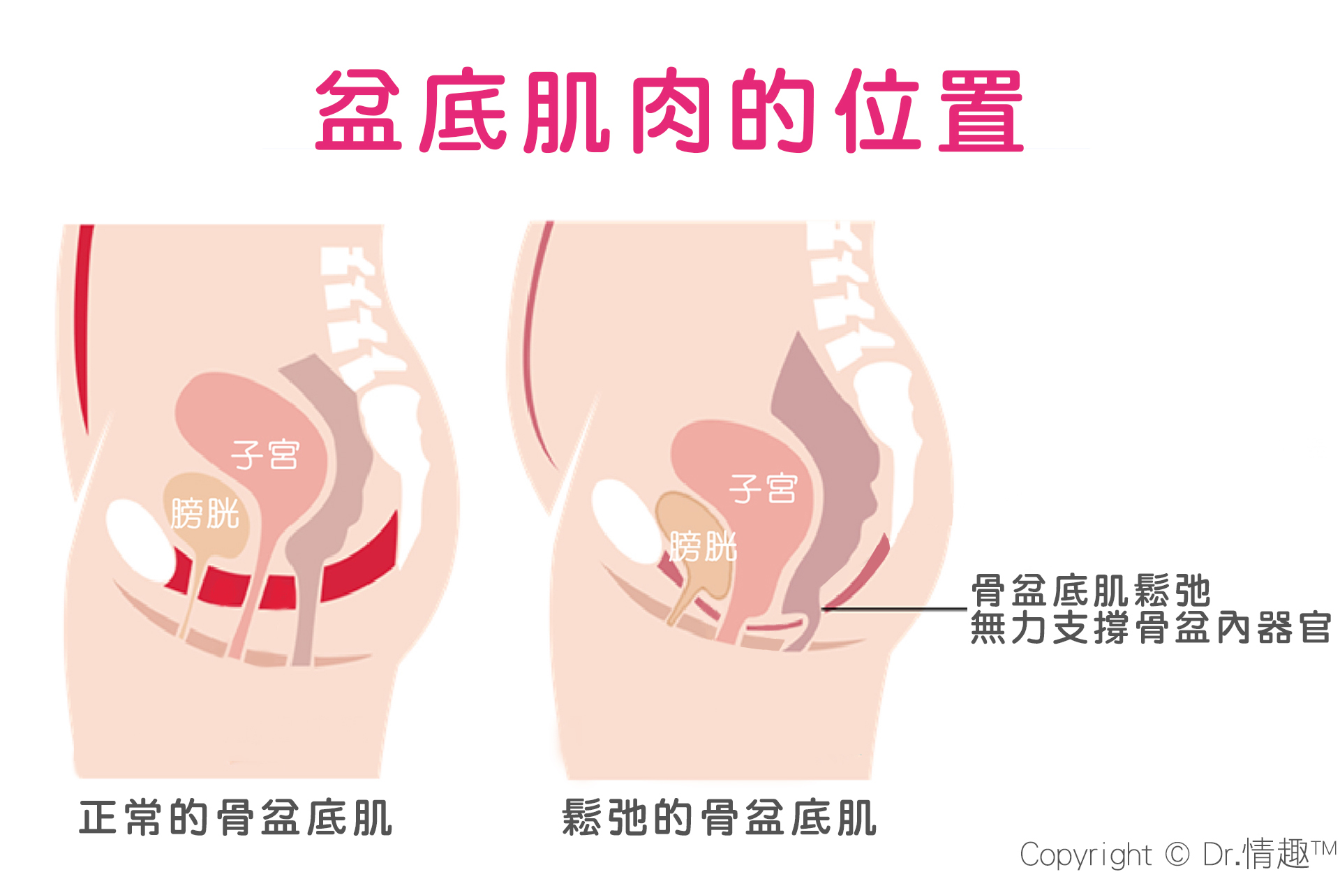 凱格爾運動 聰明球 dr.情趣  縮陰球 骨盆底肌