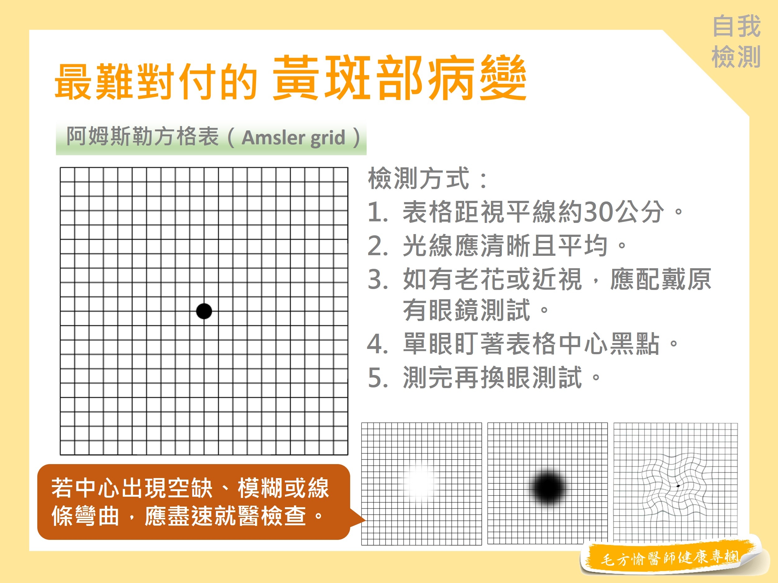 阿姆斯勒方格圖, 黃斑部病變, Amsler Grid