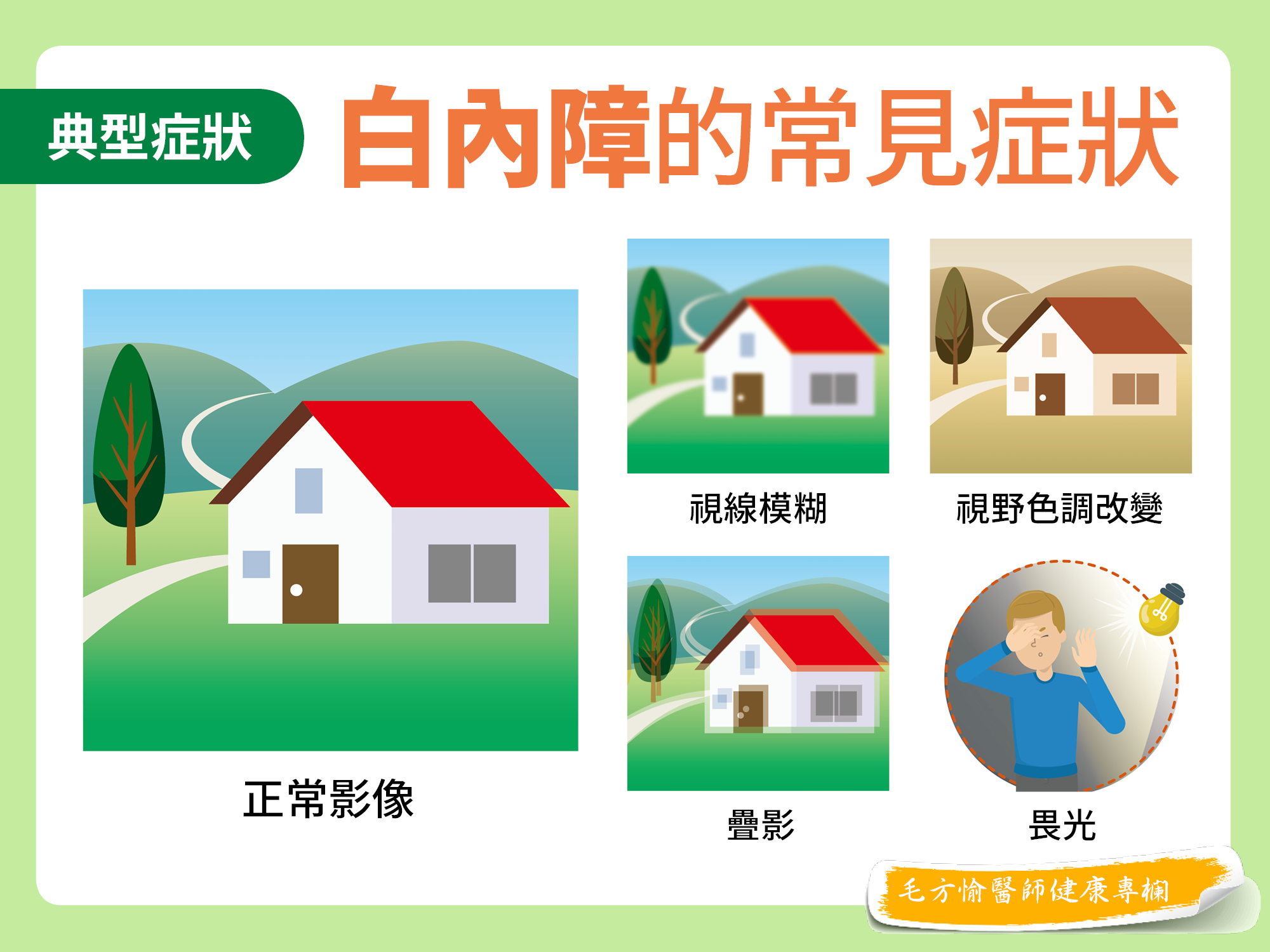 白內障, 視線模糊, 視野色調改變, 疊影, 畏光