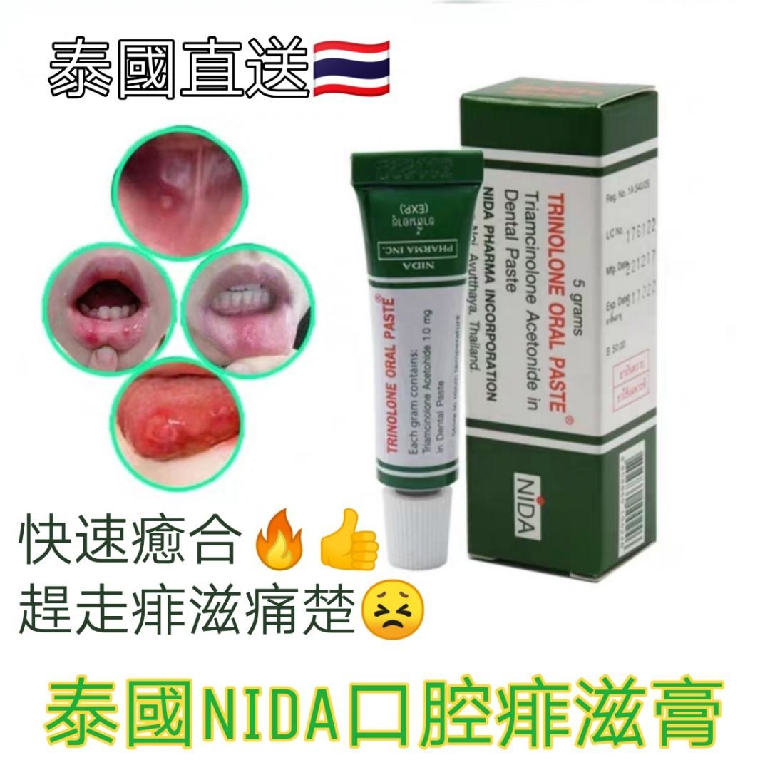 NIDA 痱滋膏 菲滋膏 飛滋膏 5g