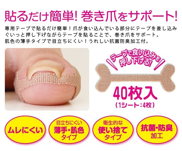 日本製腳指甲內嵌無痛矯正貼(40片)