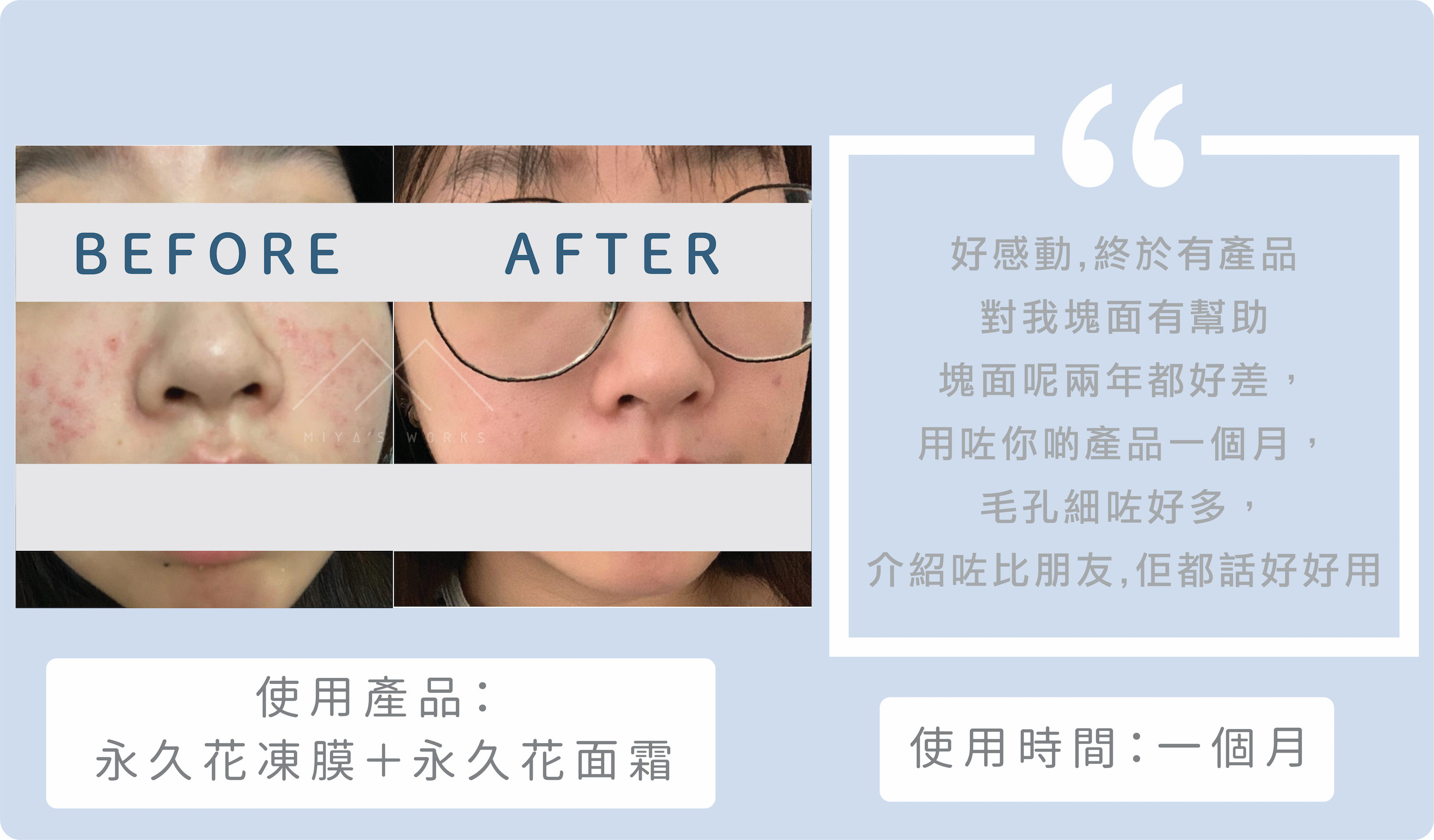 使用永久花系列產品收細毛孔