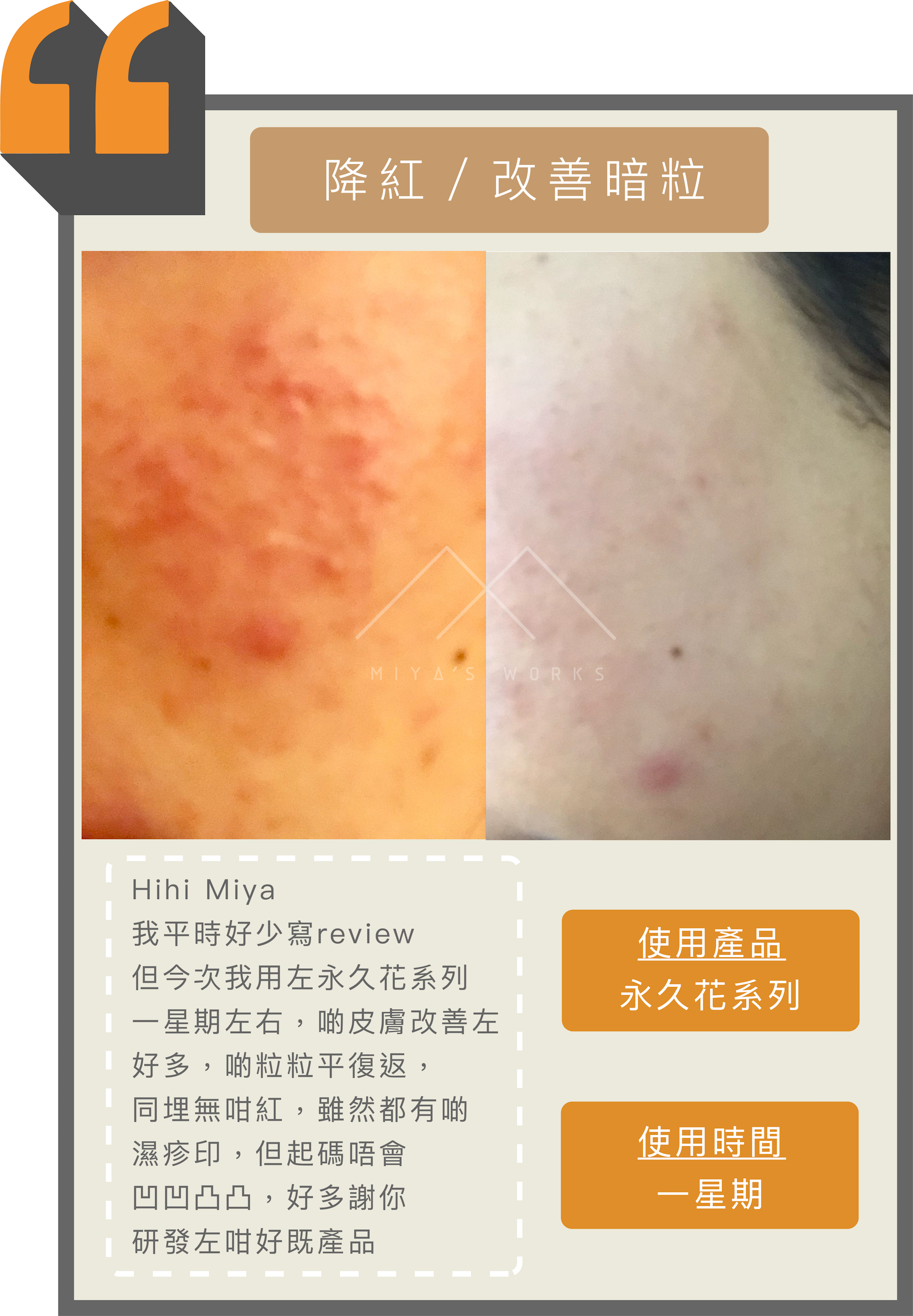 使用永久花系列產品改善暗粒及降紅