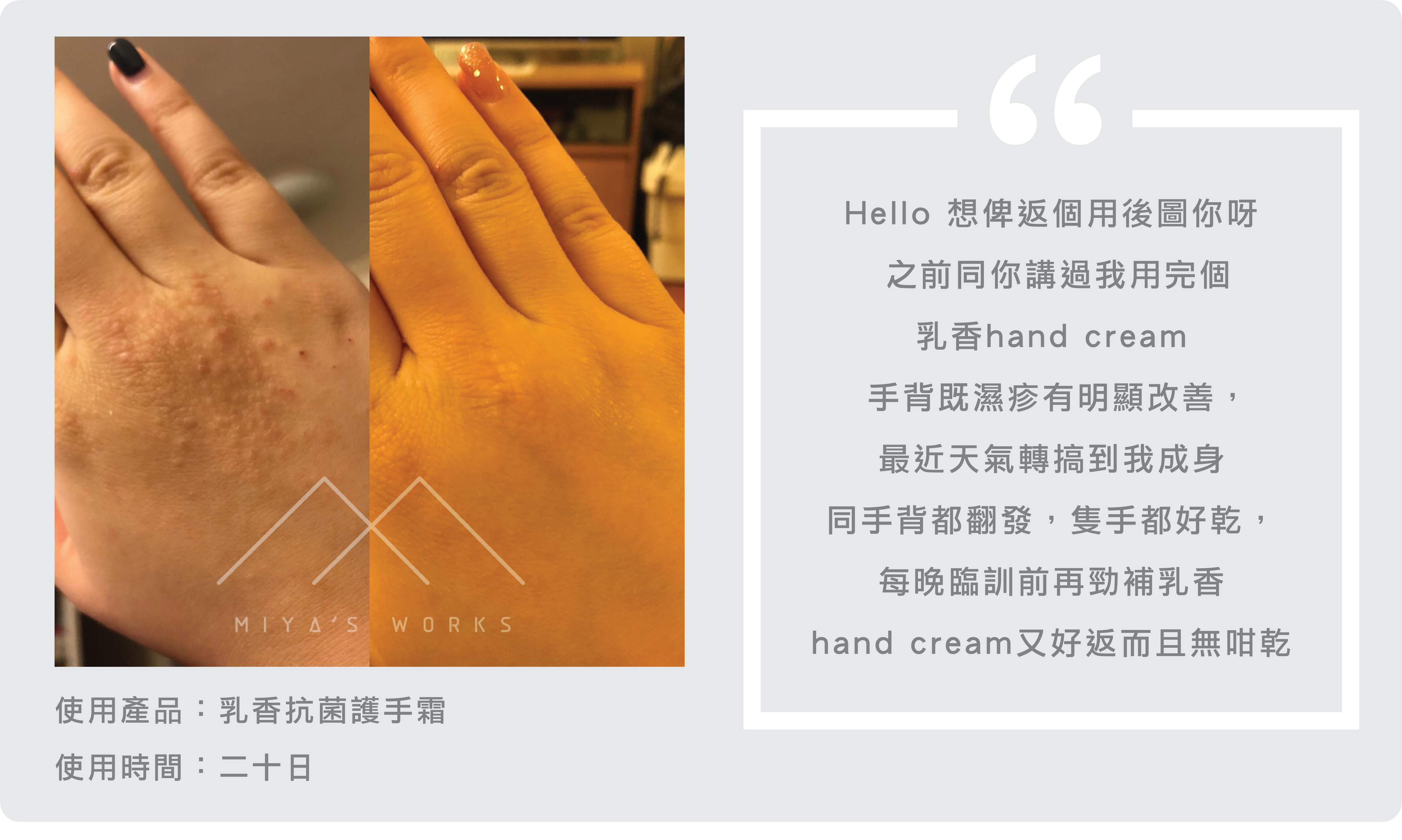 使用乳香護手霜手背濕疹明顯有改善