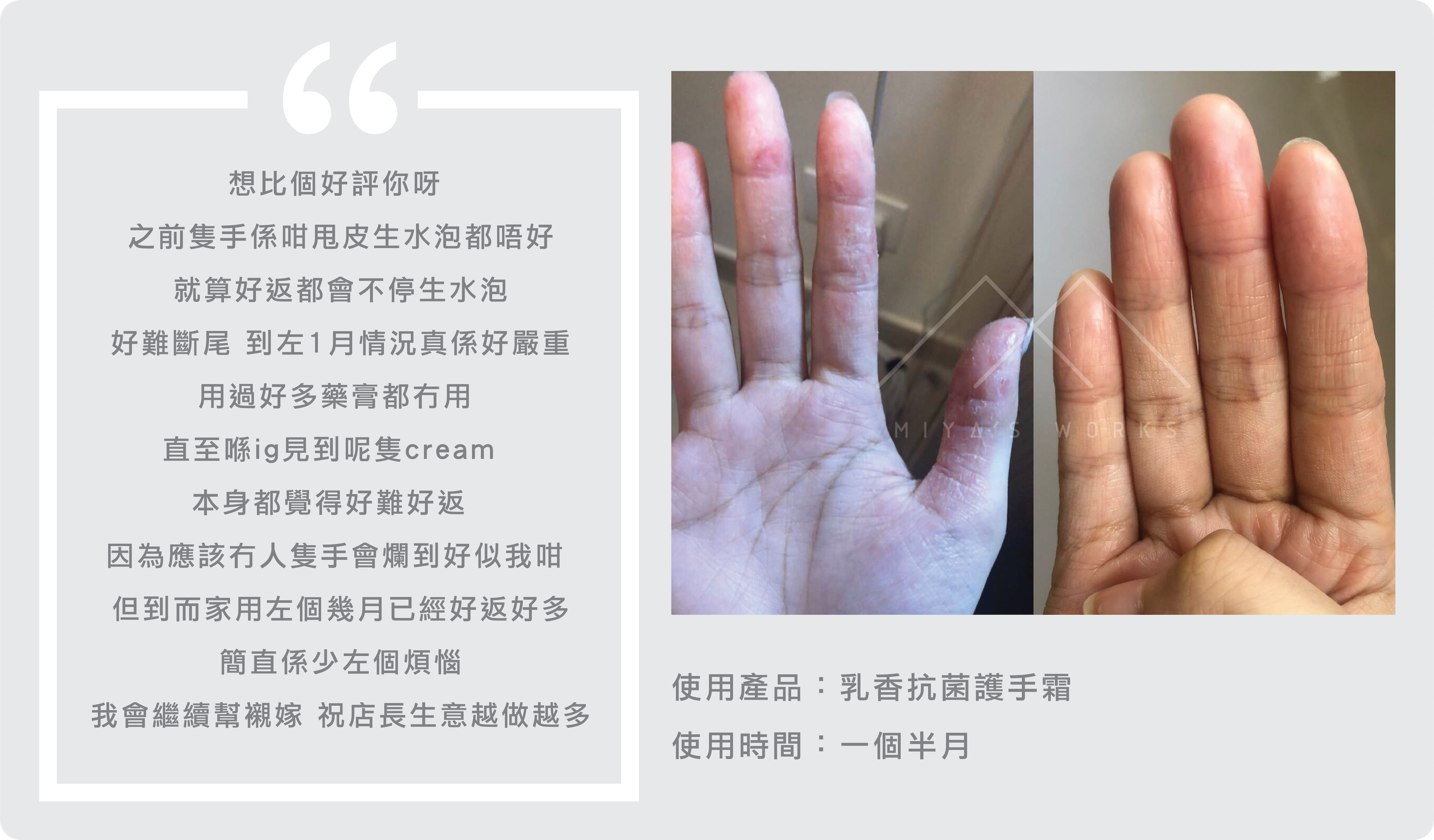手部脫皮起水泡使用乳香護手霜有好轉