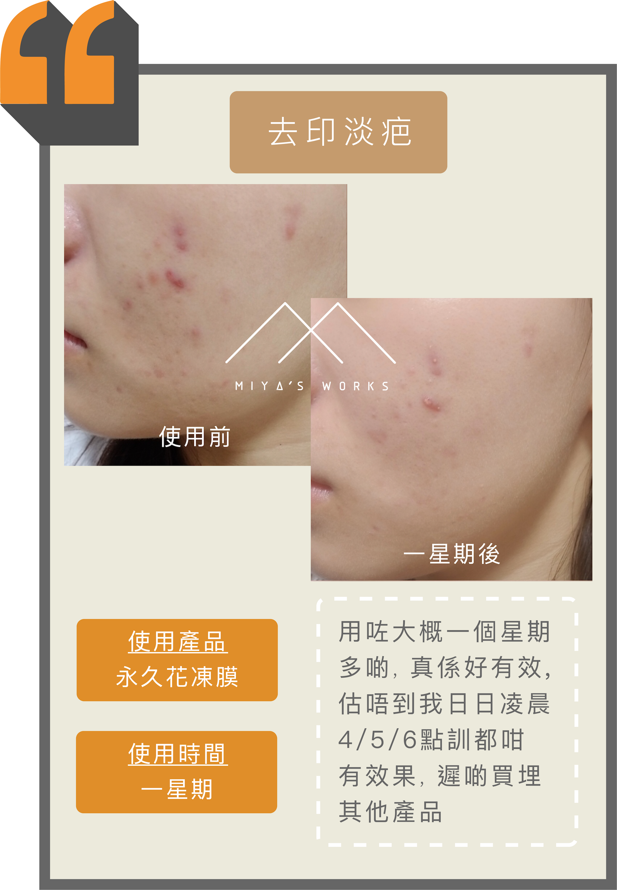 經常凌晨休息使用永久花凍膜有效去印淡疤