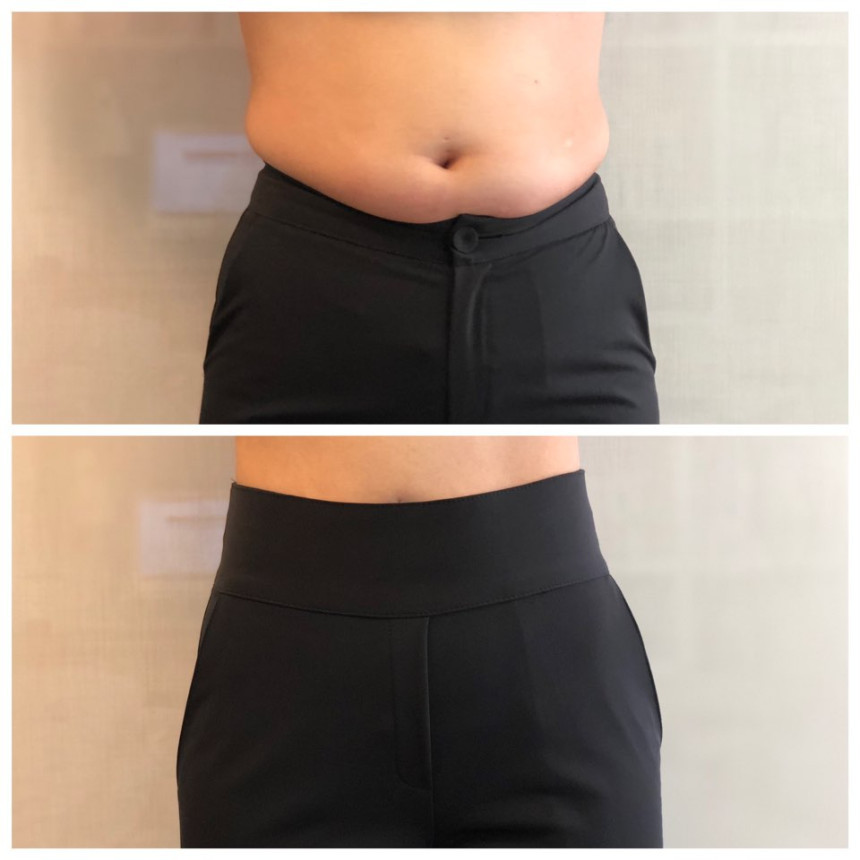 東大門皇牌✨PT01 魔法收腹顯瘦彈力西褲