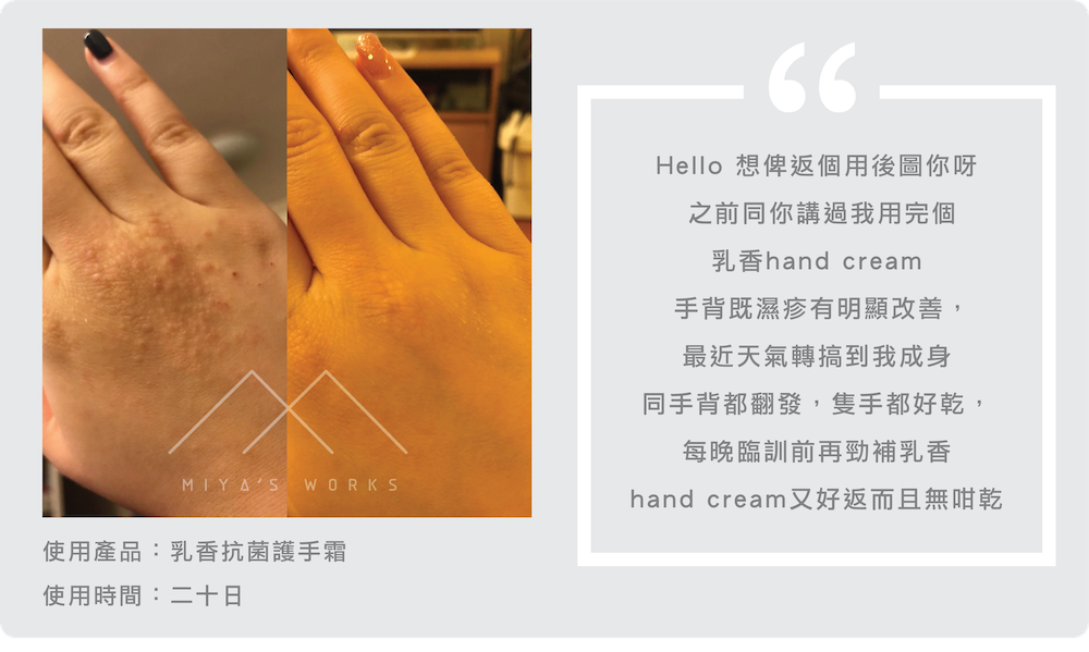 使用乳香護手霜手背濕疹明顯有改善