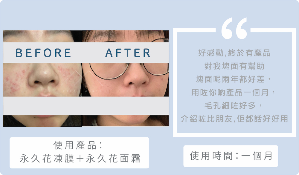 使用永久花系列產品收細毛孔