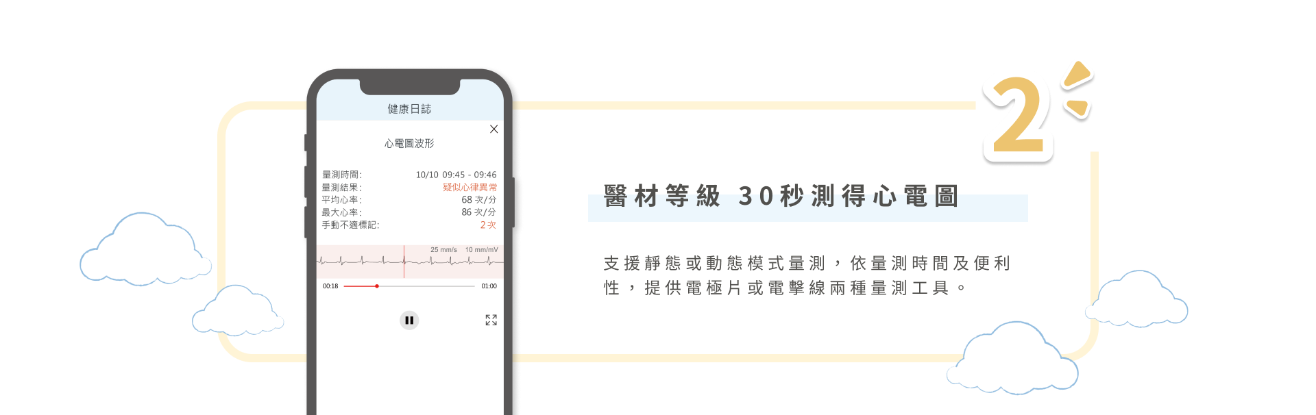 醫材等級,30秒測得心電圖
