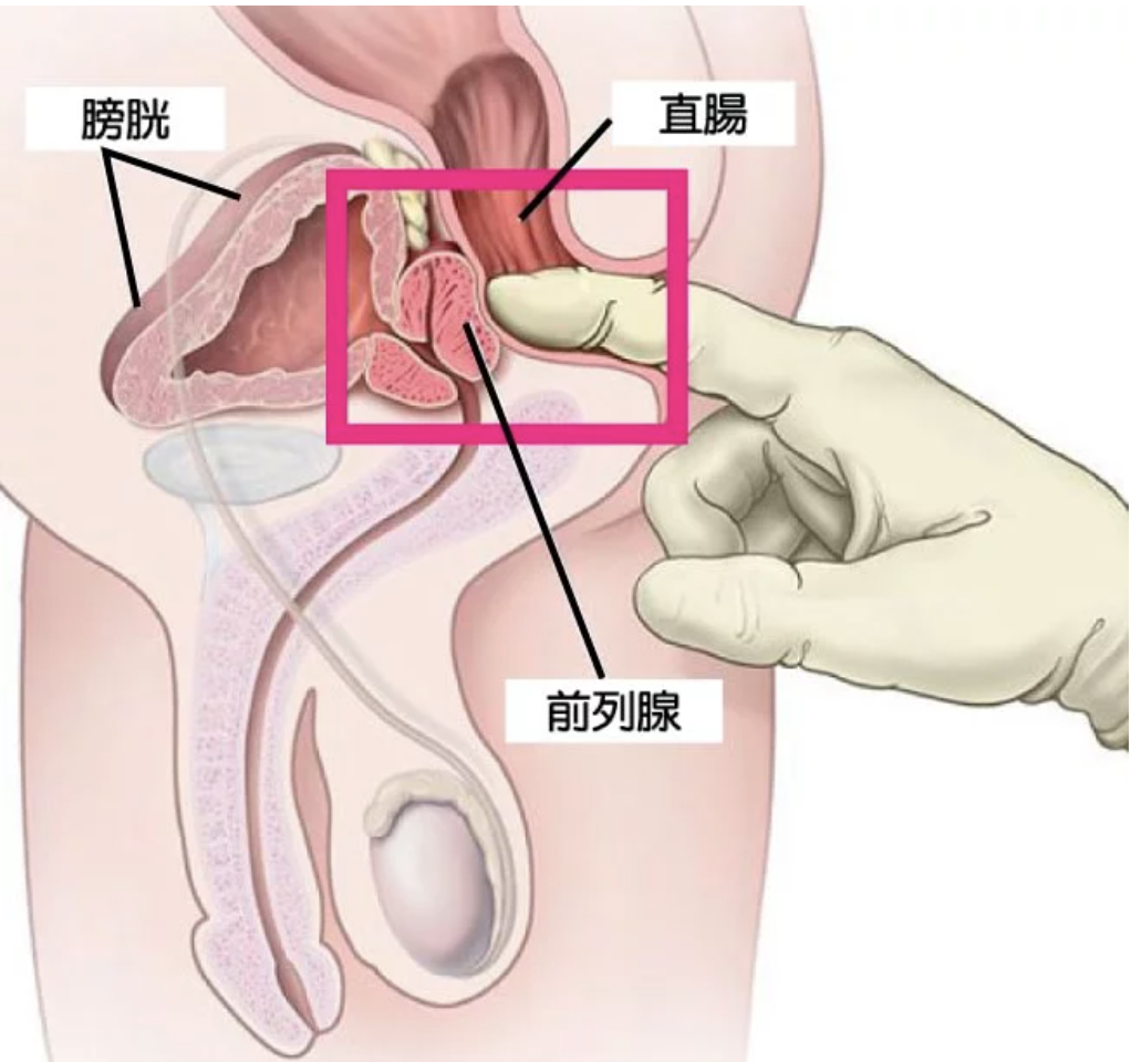 情趣第一購物中心Dr.情趣|情趣專欄|肛塞|肛交|肛塞推薦|前列腺|男生前列腺|前列腺高潮|最專業的【肛塞推薦】  選對肛塞,前往美麗菊花新世界