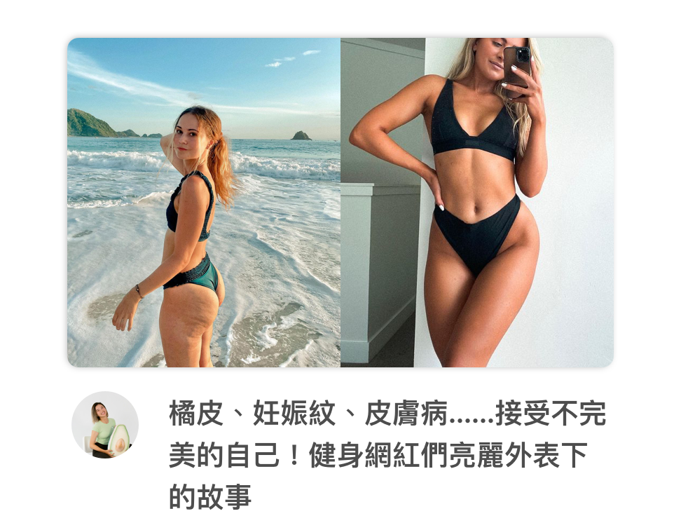 橘皮 皮膚病 妊娠紋 接受不完美