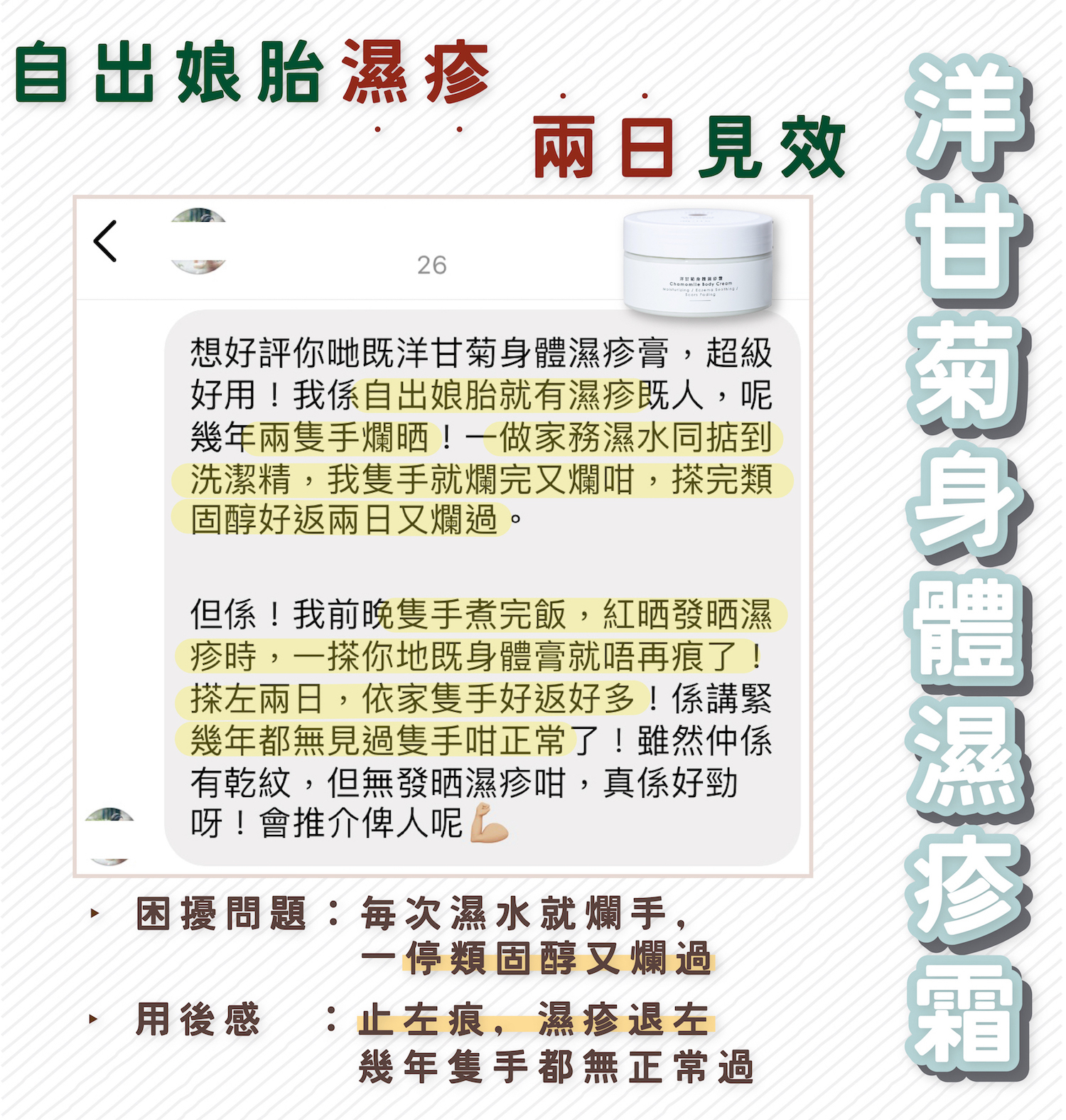 受濕疹困擾每次濕水就爛手使用洋甘菊身體濕疹霜成功止痕退濕疹