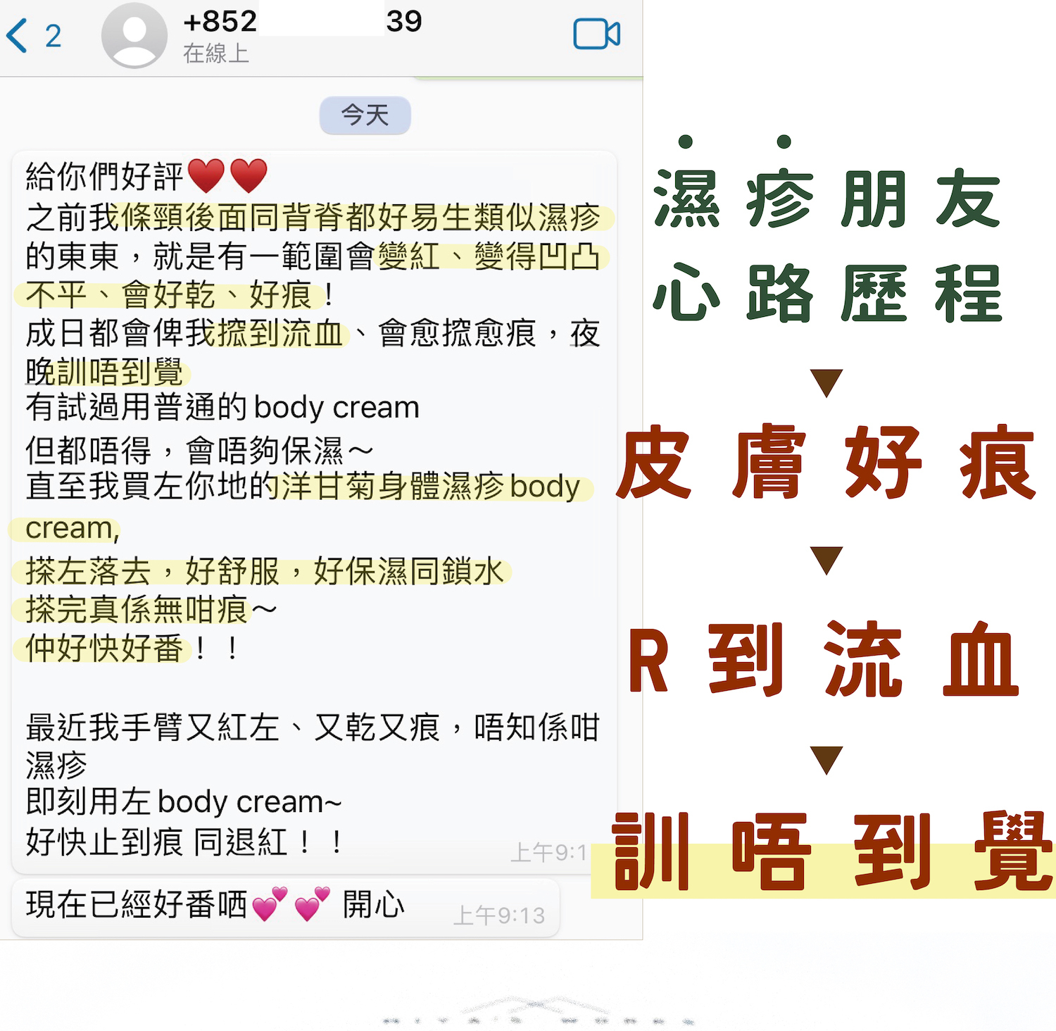 濕疹皮膚痕癢搲到流血及失眠使用洋甘菊身體濕疹霜極速止痕退紅