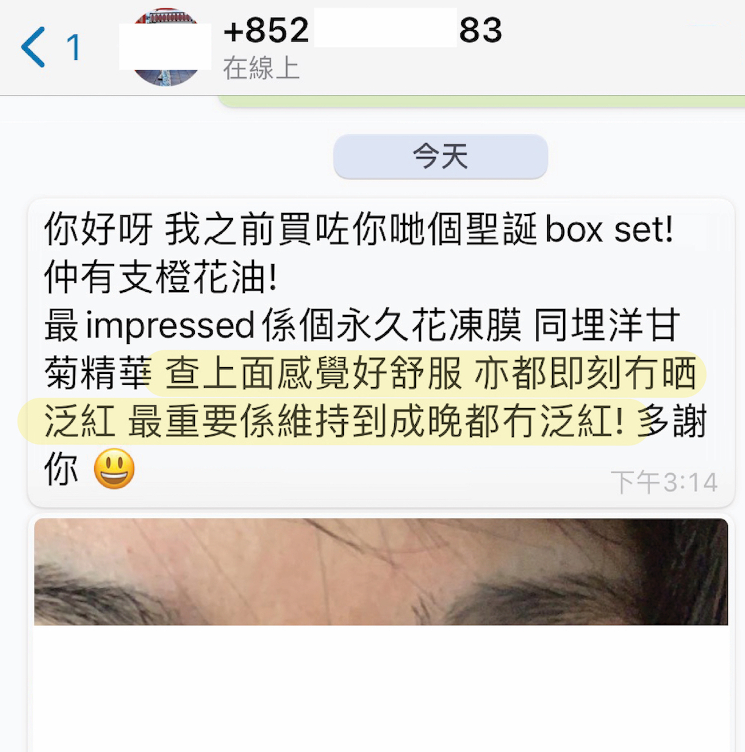 使用永久花凍膜改善泛紅