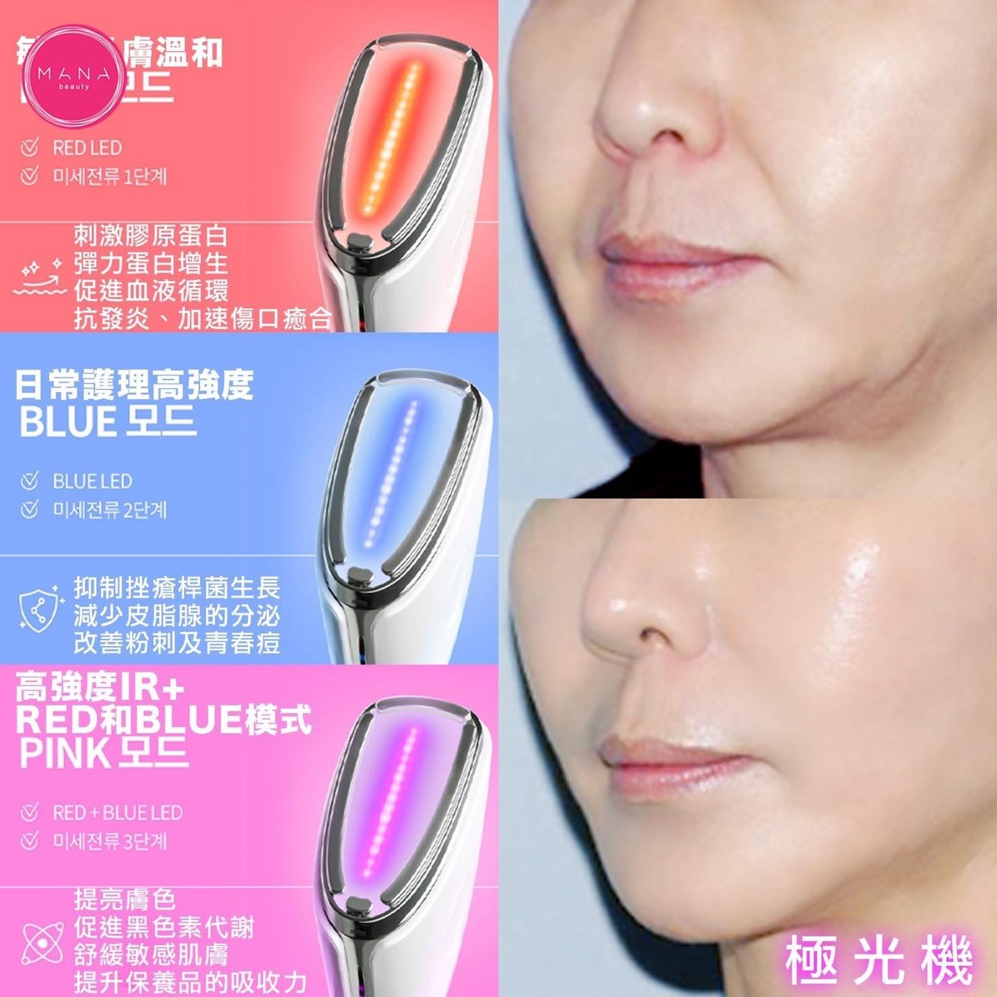 韓國🇰🇷美肌儀 (極光機)