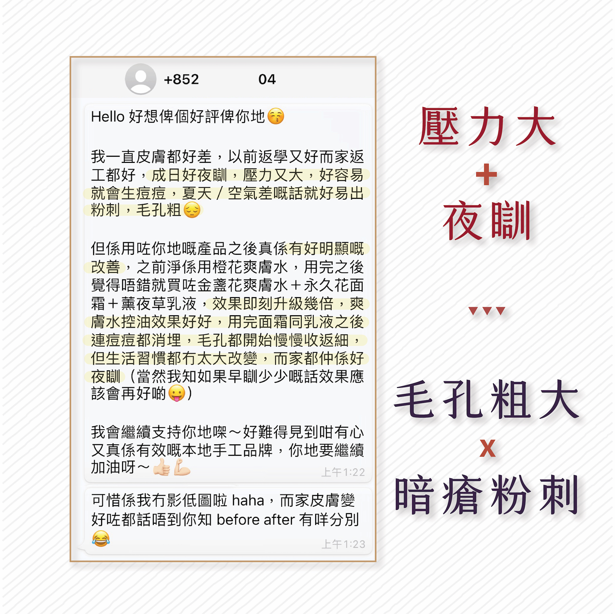 使用永久花面霜消除痘痘