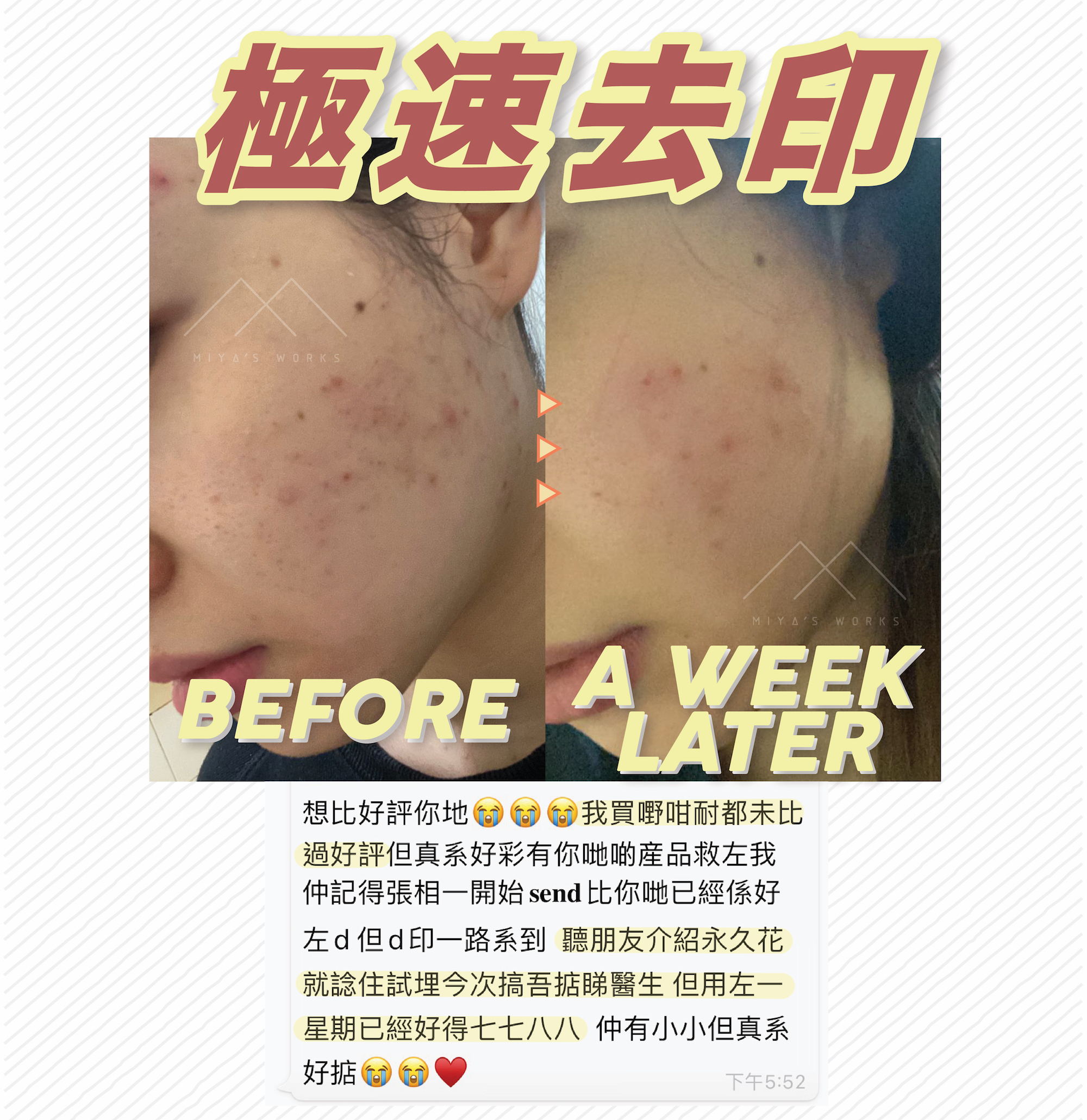 使用永久花系列產品極速去印