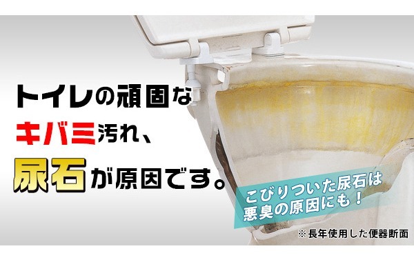 Aimedia 尿石殺手 清香型 300ml