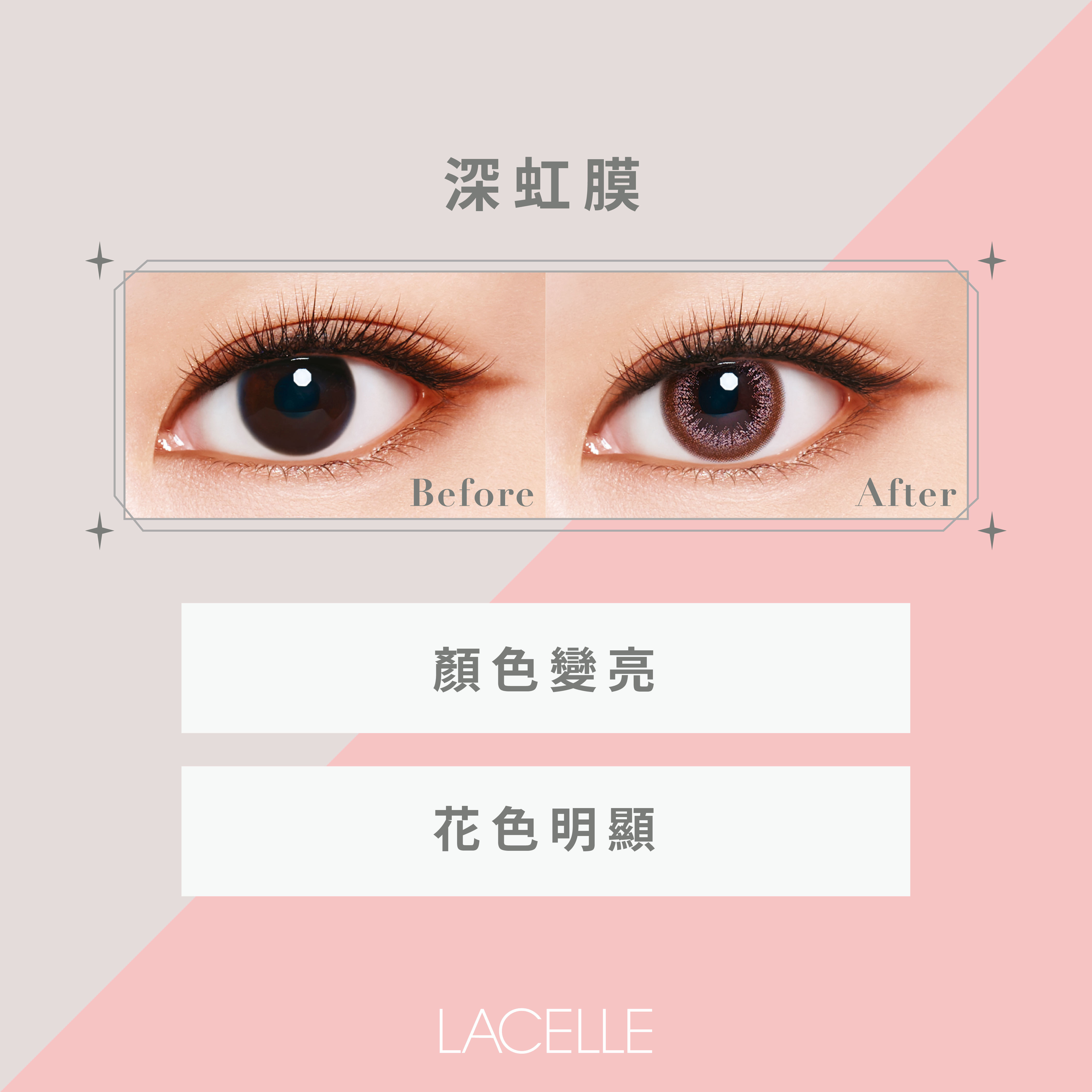 深虹膜上花色就會變亮也會比較明顯