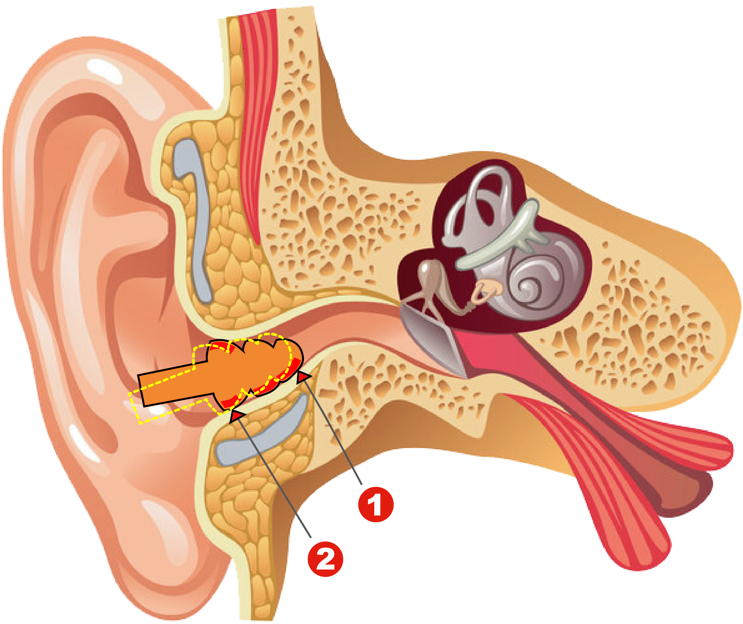 Universal Earplugs Wearing Simulation